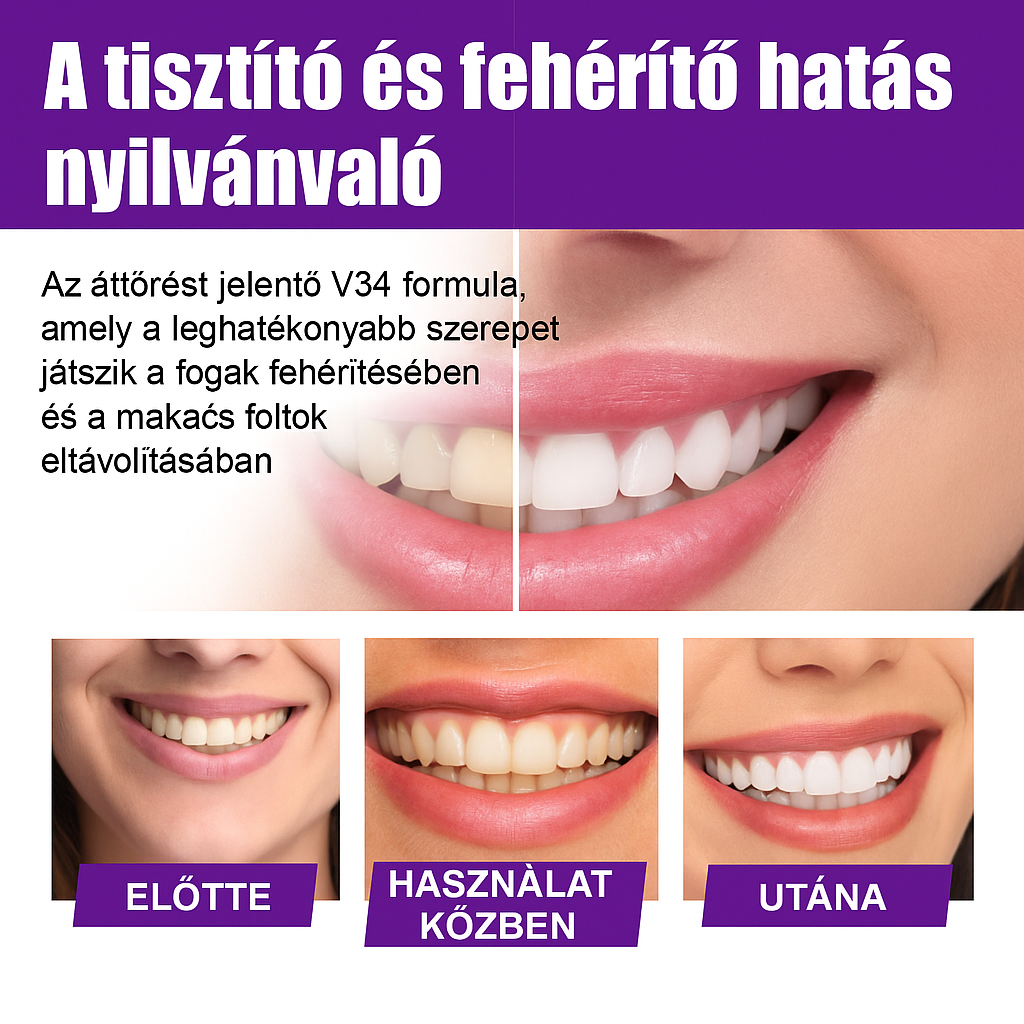 WHITE GLO fogfehérítő szérum 50 ml